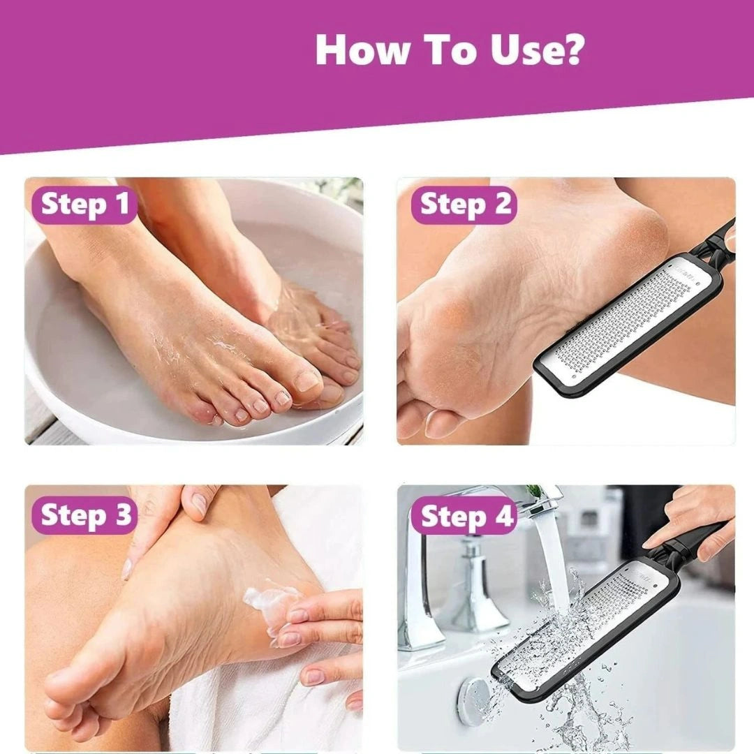 Stainless Steel Callus Remover