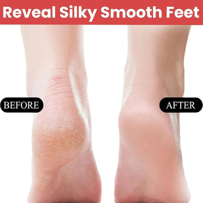 Stainless Steel Callus Remover
