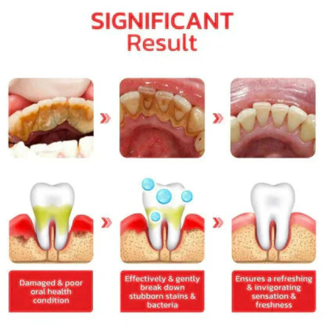 SP-4 Probiotic Brightening and cleaning toothpaste