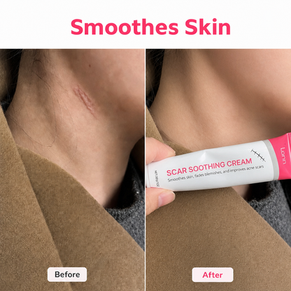 Scar Soothing Cream