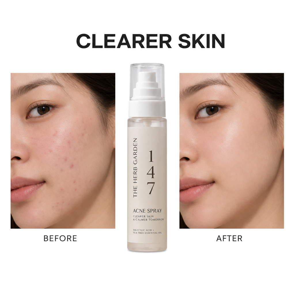 Body Acne Mist Spray