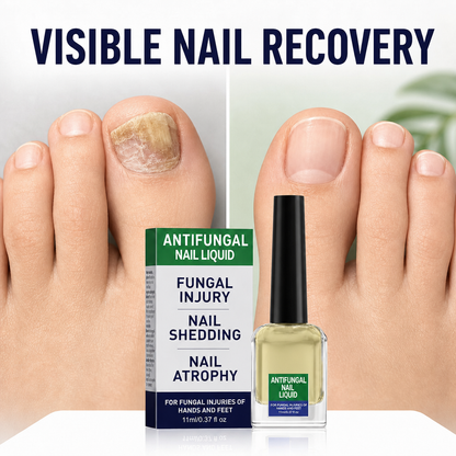BeamBalm Antifungal Nail Liquid
