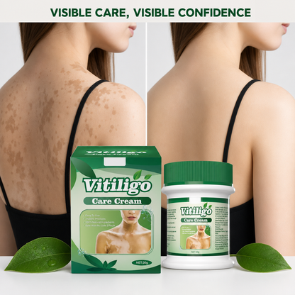 Vitiligo Care Cream