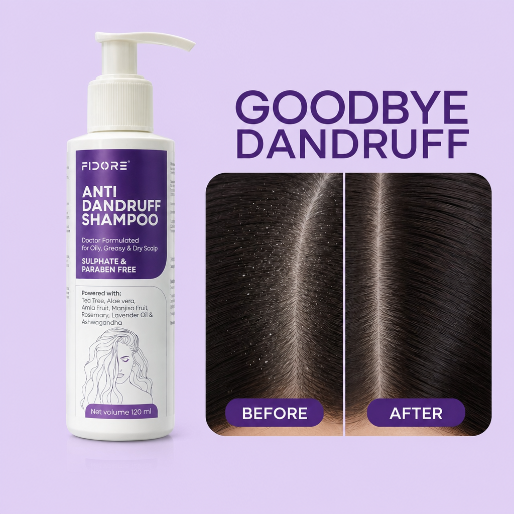 Rosemary Anti-Dandruff Shampoo