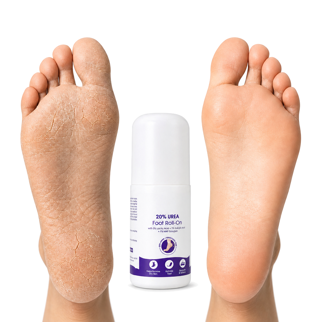 Foot Relief  Roll-On