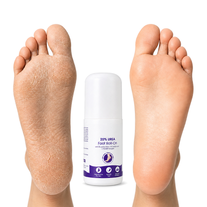 Foot Relief  Roll-On