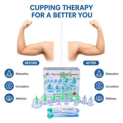 Vacuum Cupping Massager Set