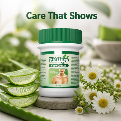 Vitiligo Care Cream
